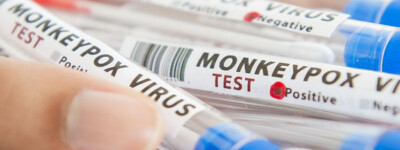 В Испании зарегистрировано 5792 подтвержденных случая вируса оспы обезьян