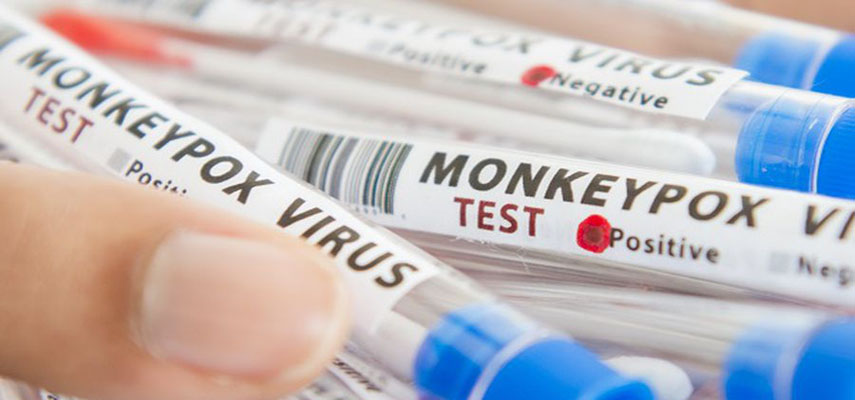 Мадрид возглавляет региональный список с 2094 случаями вируса оспы обезьян