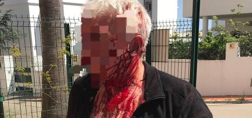 В Испании сквоттеры жестоко избили домовладельца из Великобритании